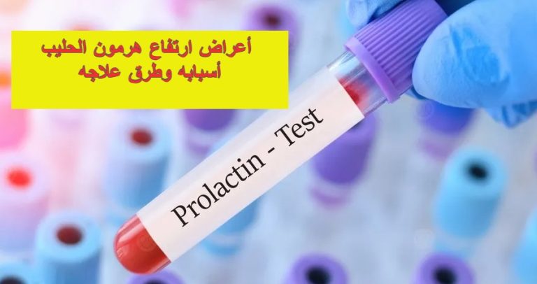 أعراض ارتفاع هرمون الحليب وأسبابه وطرق علاجه