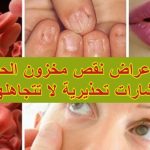 أعراض نقص مخزون الحديد: إشارات تحذيرية لا تتجاهلها