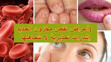 أعراض نقص مخزون الحديد: إشارات تحذيرية لا تتجاهلها