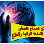 علاج الصداع النصفي: الأسباب الشائعة وطرق الوقاية والعلاج