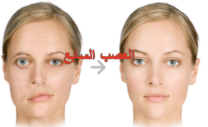 العصب السابع ووظائفه: دليلك الشامل لأسبابه وأعراضه وطرق الوقاية والعلاج