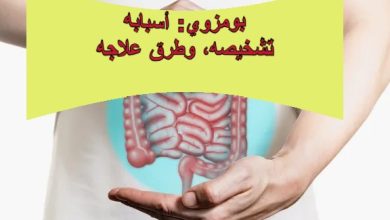 **بومزوي: أسبابه، تشخيصه، وطرق علاجه**