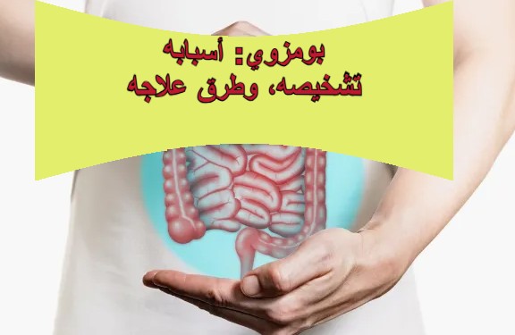 **بومزوي: أسبابه، تشخيصه، وطرق علاجه**