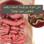 جرثومة المعدة