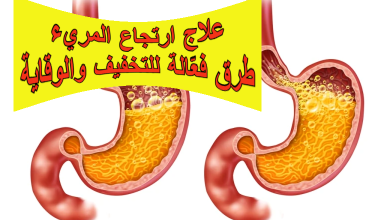 علاج ارتجاع المريء: طرق فعّالة للتخفيف والوقاية