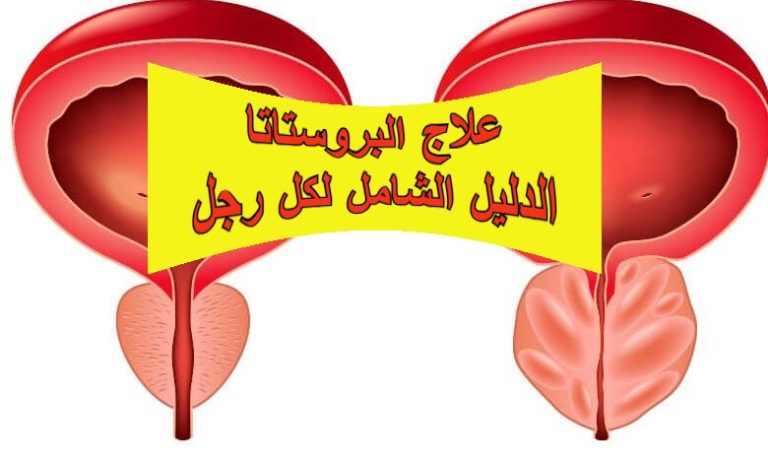 علاج البروستاتا: الدليل الشامل لكل رجل
