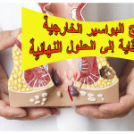 علاج البواسير الخارجية: من الوقاية إلى الحلول النهائية