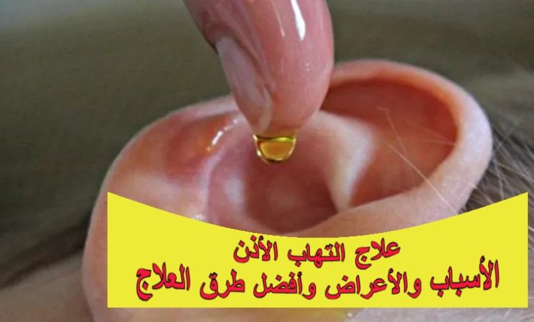 علاج التهاب الأذن: الأسباب والأعراض وأفضل طرق العلاج
