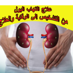 علاج التهاب البول: من التشخيص إلى الوقاية والعلاج