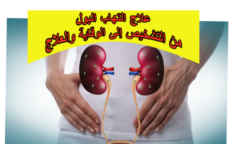 علاج التهاب البول: من التشخيص إلى الوقاية والعلاج