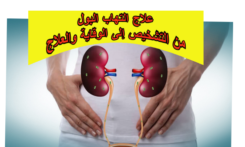 علاج التهاب البول: من التشخيص إلى الوقاية والعلاج