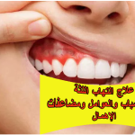 علاج التهاب اللثة: أهم الأسباب والعوامل المؤثرة ومضاعفات الإهمال
