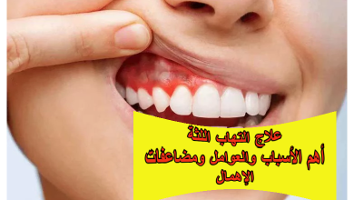 علاج التهاب اللثة: أهم الأسباب والعوامل المؤثرة ومضاعفات الإهمال