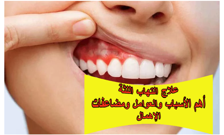 علاج التهاب اللثة: أهم الأسباب والعوامل المؤثرة ومضاعفات الإهمال