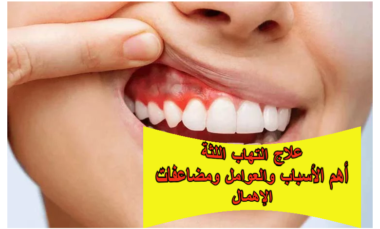علاج التهاب اللثة: أهم الأسباب والعوامل المؤثرة ومضاعفات الإهمال