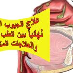 علاج الجيوب الأنفية نهائياً بين الطب الحديث والعلاجات المنزلية