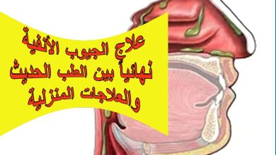 علاج الجيوب الأنفية نهائياً بين الطب الحديث والعلاجات المنزلية