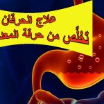 علاج الحرقان: تخلّص من حرقة المعدة نهائيًا
