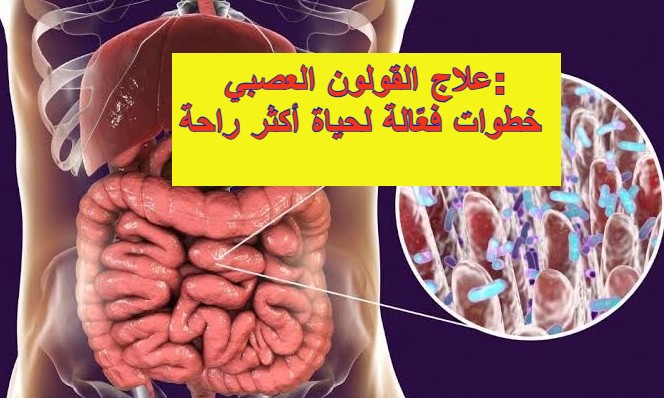 علاج القولون العصبي: خطوات فعّالة لحياة أكثر راحة