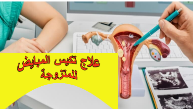 علاج تكيس المبايض للمتزوجة: حلول طبية وطبيعية لتعزيز فرص الحمل