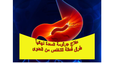 علاج جرثومة المعدة نهائيا