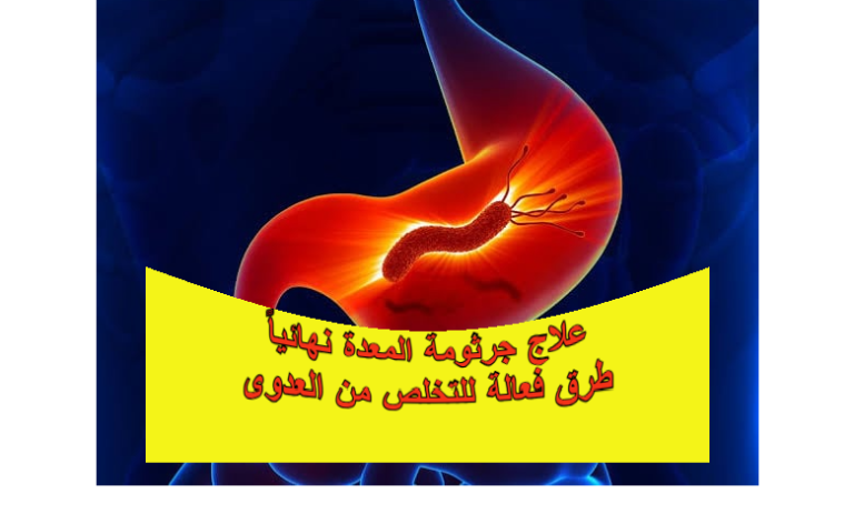 علاج جرثومة المعدة نهائيا