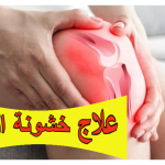 علاج خشونة الركبة: الأسباب، الأعراض، الطرق الطبيعية والطبية