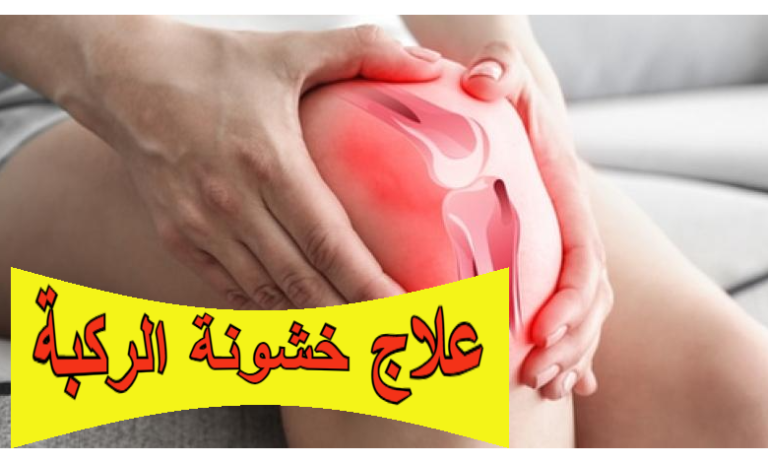 علاج خشونة الركبة: الأسباب، الأعراض، الطرق الطبيعية والطبية