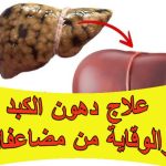 علاج دهون الكبد والوقاية من مضاعفاته