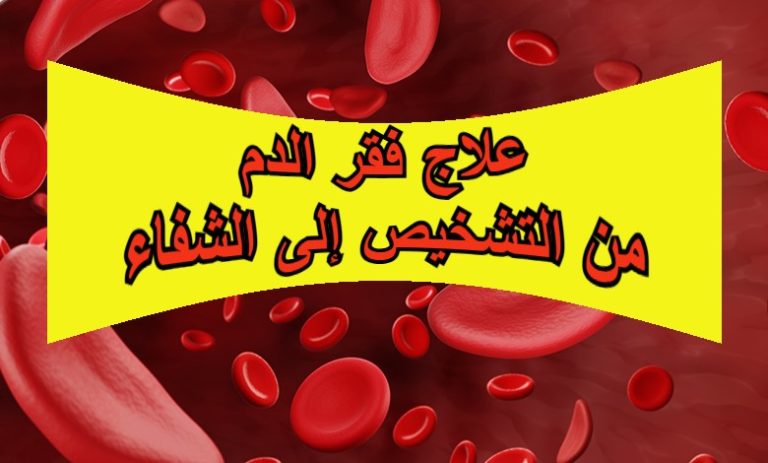 علاج فقر الدم: من التشخيص إلى الشفاء