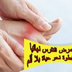 علاج مرض النقرس نهائيا خطوة بخطوة نحو حياة بلا ألم