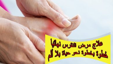 علاج مرض النقرس نهائيا خطوة بخطوة نحو حياة بلا ألم