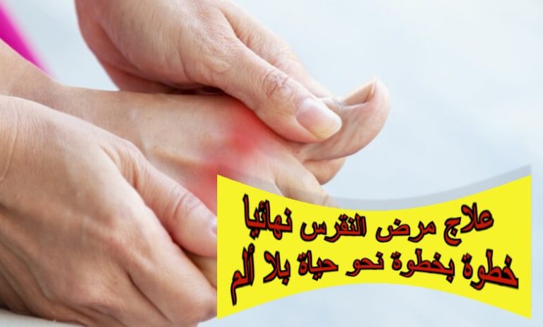 علاج مرض النقرس نهائيا خطوة بخطوة نحو حياة بلا ألم