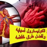 ارتفاع الكوليسترول أسبابه أنواعه وأفضل طرق خفضه