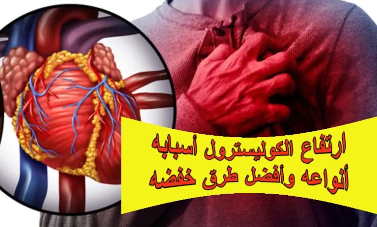 ارتفاع الكوليسترول أسبابه أنواعه وأفضل طرق خفضه
