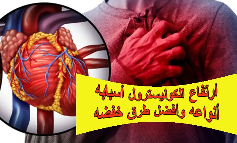 ارتفاع الكوليسترول أسبابه أنواعه وأفضل طرق خفضه