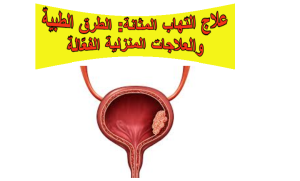 علاج التهاب المثانة: الطرق الطبية والعلاجات المنزلية الفعّالة