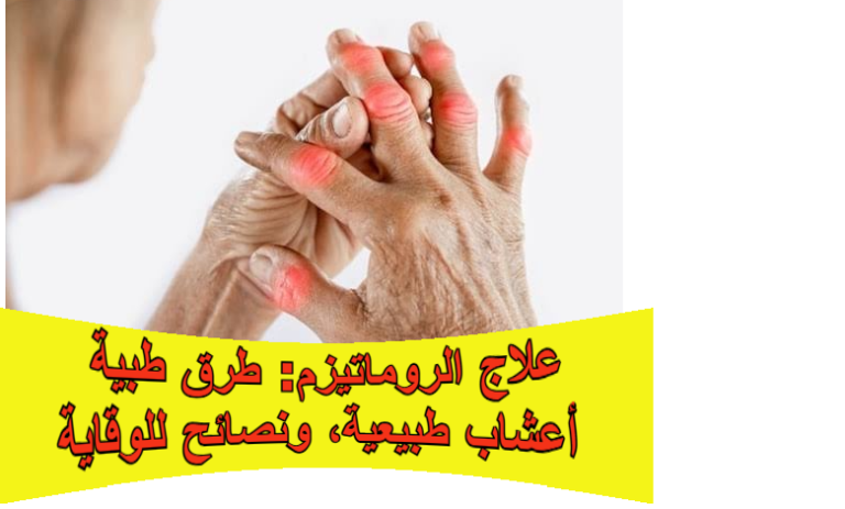 علاج الروماتيزم: طرق طبية، أعشاب طبيعية، ونصائح للوقاية
