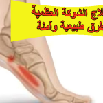 علاج الشوكة العظمية بطرق طبيعية وآمنة