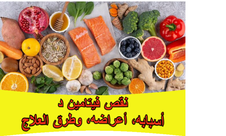 نقص فيتامين د: أسبابه، أعراضه، وطرق العلاج
