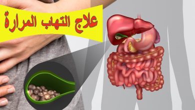 علاج التهاب المرارة: الأسباب، الأعراض، المضاعفات وطرق الوقاية
